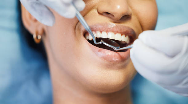 Best Broken or Chipped Tooth Repair in La Marque, TX