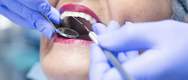 Best Dental Abscess Treatment in La Marque, TX